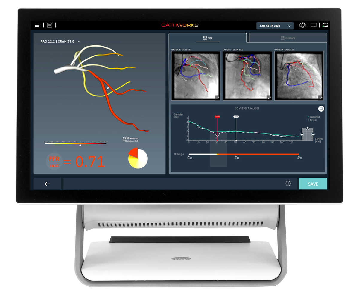 CathWorks FFRangio System